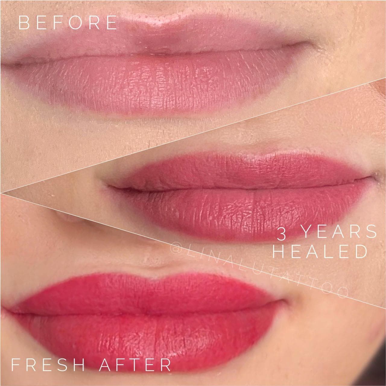 Embrace Permanent Lip Blushing