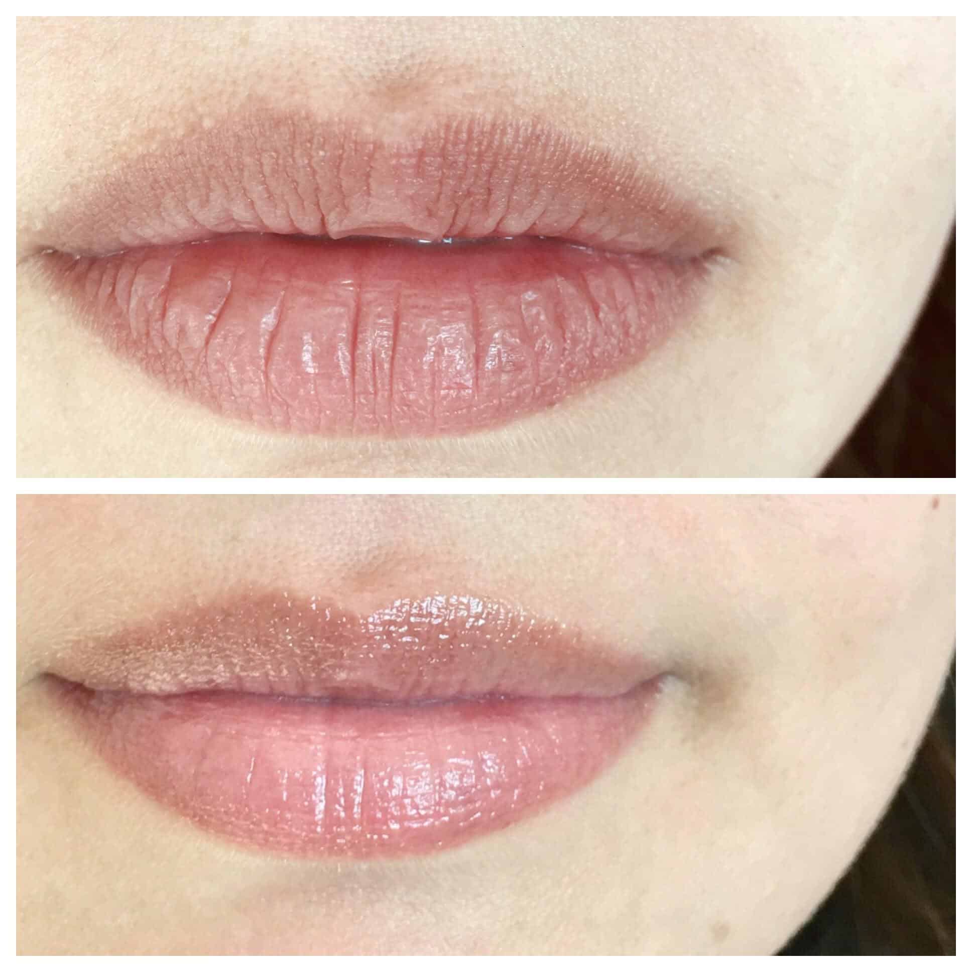 Hydration Healthier Lips