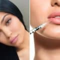 Is There Danger in Lip Injections?