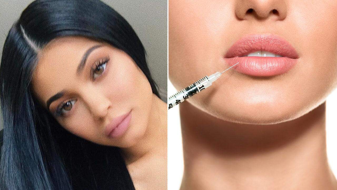 Read more about the article Is There Danger in Lip Injections?