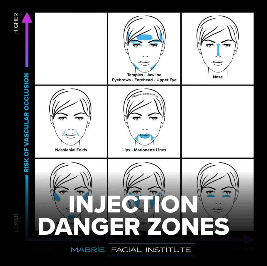 Risks FDAApproved Fillers