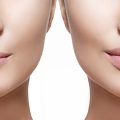 Options for People With Thin Lips